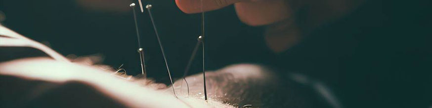 la-acupuntura-es-un-tratamiento-efectivo-contra-la-drogadiccion